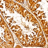 Immunohistochemistry - Anti-GSK3 beta + GSK3 alpha (Phospho Y216 & Phospho Y279) Antibody (A16552) - Antibodies.com