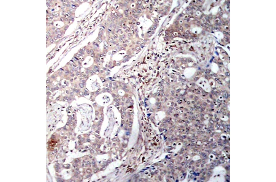 Immunohistochemistry - Anti-NFKBIB (phospho S23) Antibody (AP0262) - Antibodies.com