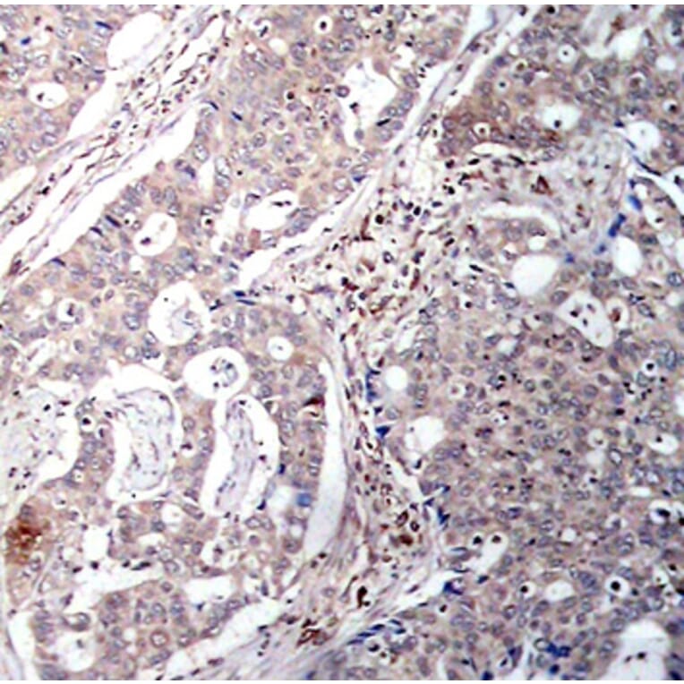 Immunohistochemistry - Anti-NFKBIB (phospho S23) Antibody (AP0262) - Antibodies.com