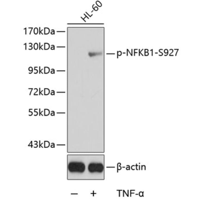 Western Blot - Anti-NFkB p105 (phospho Ser927) Antibody (A16554) - Antibodies.com