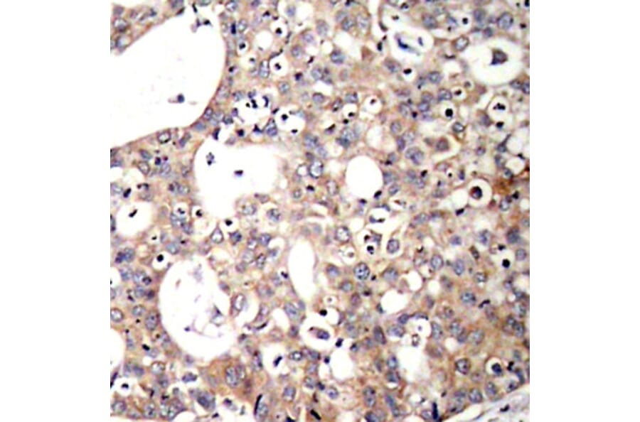 Immunohistochemistry - Anti-SHC1 (phospho Y427) Antibody (AP0266) - Antibodies.com