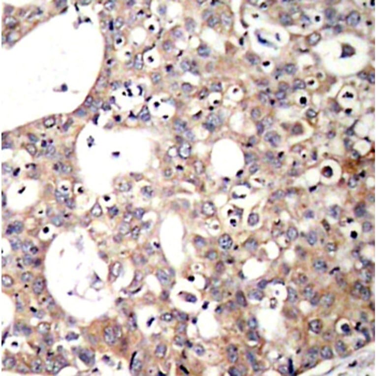 Immunohistochemistry - Anti-SHC1 (phospho Y427) Antibody (AP0266) - Antibodies.com