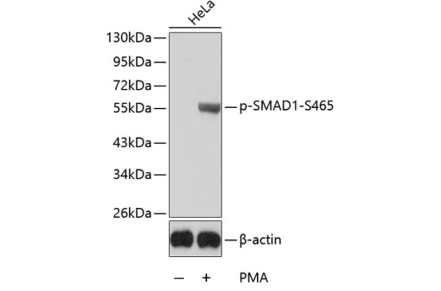 Western Blot - Anti-SMAD1 (phospho S465) Antibody (AP0268) - Antibodies.com