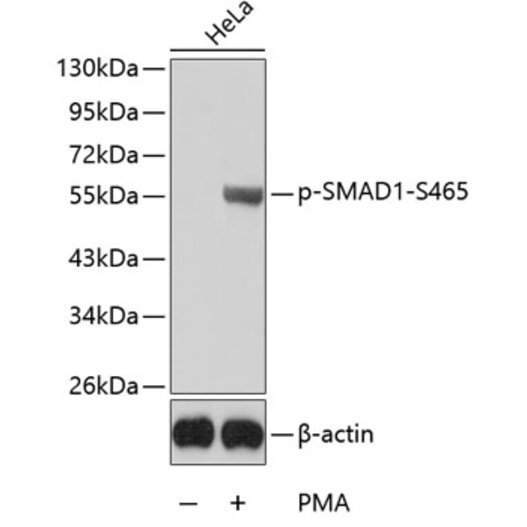 Western Blot - Anti-SMAD1 (phospho S465) Antibody (AP0268) - Antibodies.com