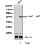 Western Blot - Anti-SMAD1 (phospho S465) Antibody (AP0268) - Antibodies.com