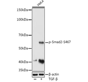 Western Blot - Anti-Smad2 (phospho Ser467) Antibody (A16558) - Antibodies.com