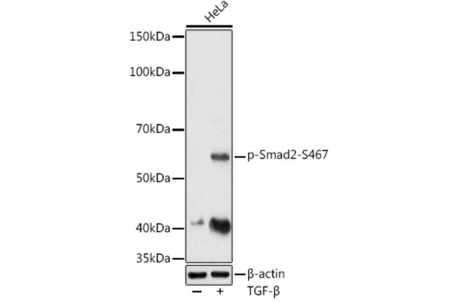 Western Blot - Anti-Smad2 (phospho Ser467) Antibody (A16558) - Antibodies.com