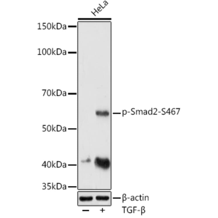 Western Blot - Anti-Smad2 (phospho Ser467) Antibody (A16558) - Antibodies.com