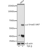 Western Blot - Anti-Smad2 (phospho Ser467) Antibody (A16558) - Antibodies.com