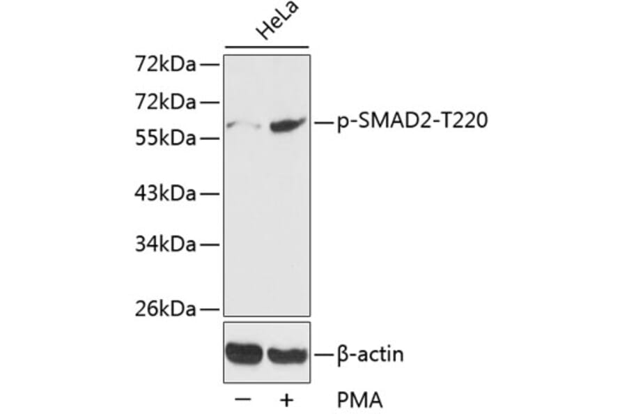 Western Blot - Anti-SMAD2 (phospho T220) Antibody (AP0270) - Antibodies.com