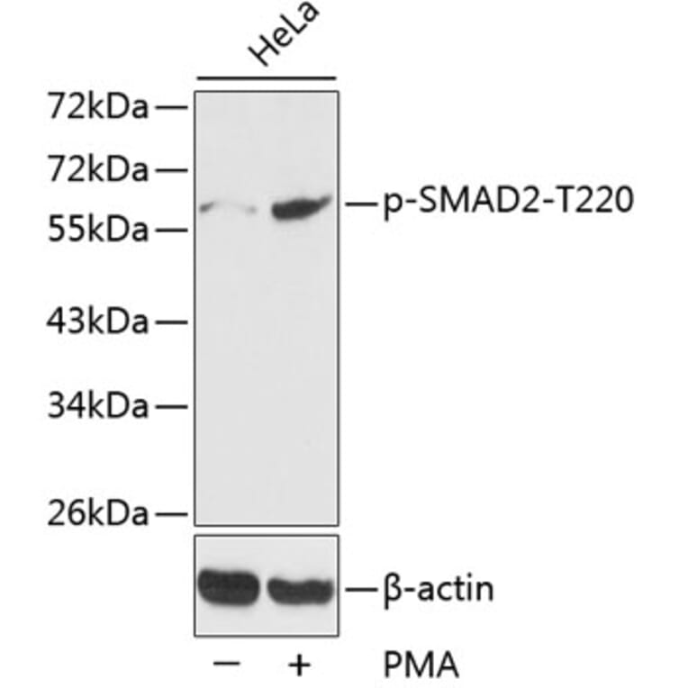 Western Blot - Anti-SMAD2 (phospho T220) Antibody (AP0270) - Antibodies.com