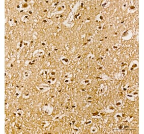 Immunohistochemistry - Anti-AKT1 (Phospho Y315) Antibody (A16561) - Antibodies.com