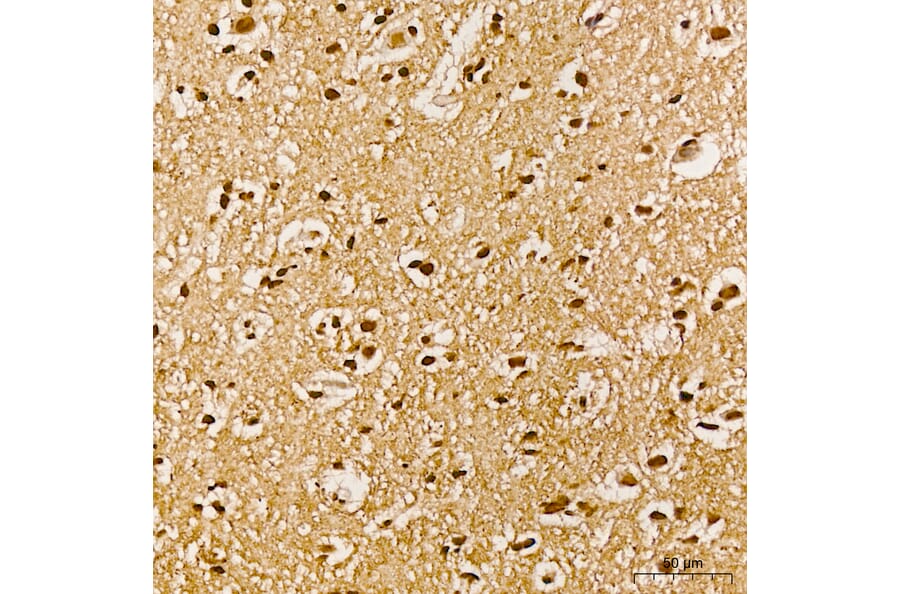 Immunohistochemistry - Anti-AKT1 (Phospho Y315) Antibody (A16561) - Antibodies.com
