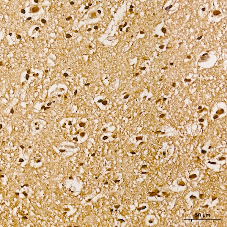 Immunohistochemistry - Anti-AKT1 (Phospho Y315) Antibody (A16561) - Antibodies.com