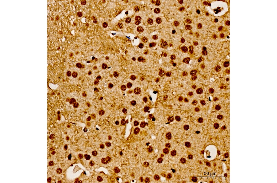 Immunohistochemistry - Anti-AKT1 (Phospho Y315) Antibody (A16561) - Antibodies.com