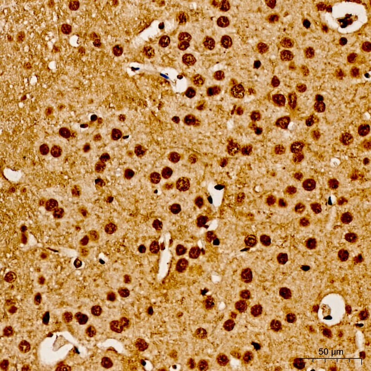 Immunohistochemistry - Anti-AKT1 (Phospho Y315) Antibody (A16561) - Antibodies.com