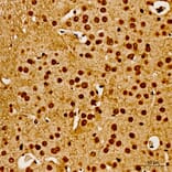Immunohistochemistry - Anti-AKT1 (Phospho Y315) Antibody (A16561) - Antibodies.com