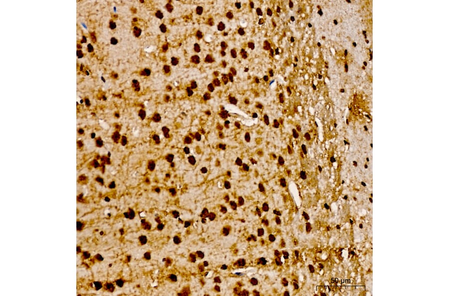 Immunohistochemistry - Anti-AKT1 (Phospho Y315) Antibody (A16561) - Antibodies.com