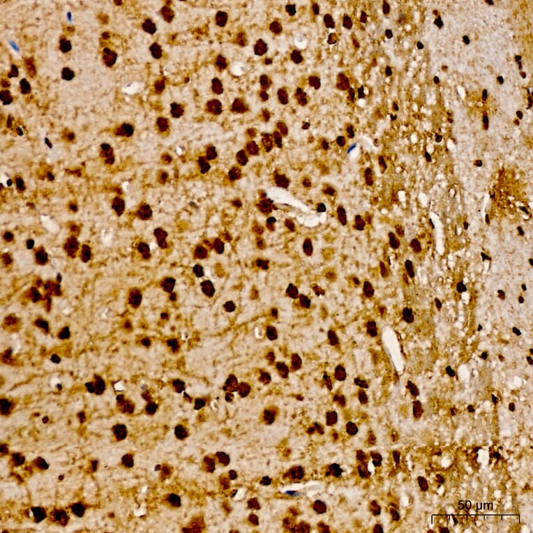 Immunohistochemistry - Anti-AKT1 (Phospho Y315) Antibody (A16561) - Antibodies.com