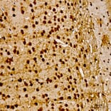 Immunohistochemistry - Anti-AKT1 (Phospho Y315) Antibody (A16561) - Antibodies.com