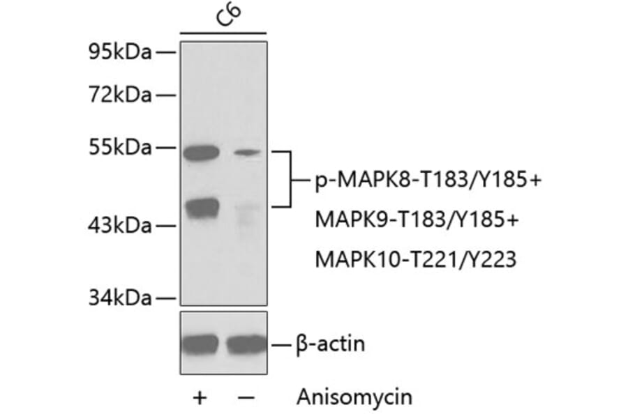 Western Blot - Anti-MAPK8 (phospho T183 + Y185) + MAPK9 (phospho T183 + Y185) + MAPK10 (phospho T221 + Y223) Antibody (AP0276) - Antibodies.com