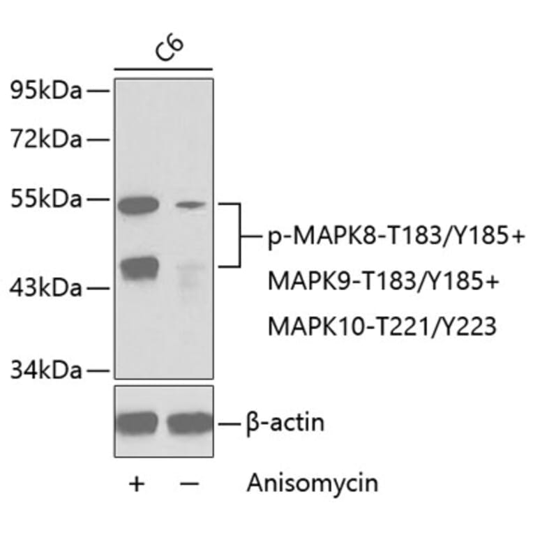 Western Blot - Anti-MAPK8 (phospho T183 + Y185) + MAPK9 (phospho T183 + Y185) + MAPK10 (phospho T221 + Y223) Antibody (AP0276) - Antibodies.com