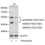 Western Blot - Anti-MAPK8 (phospho T183 + Y185) + MAPK9 (phospho T183 + Y185) + MAPK10 (phospho T221 + Y223) Antibody (AP0276) - Antibodies.com