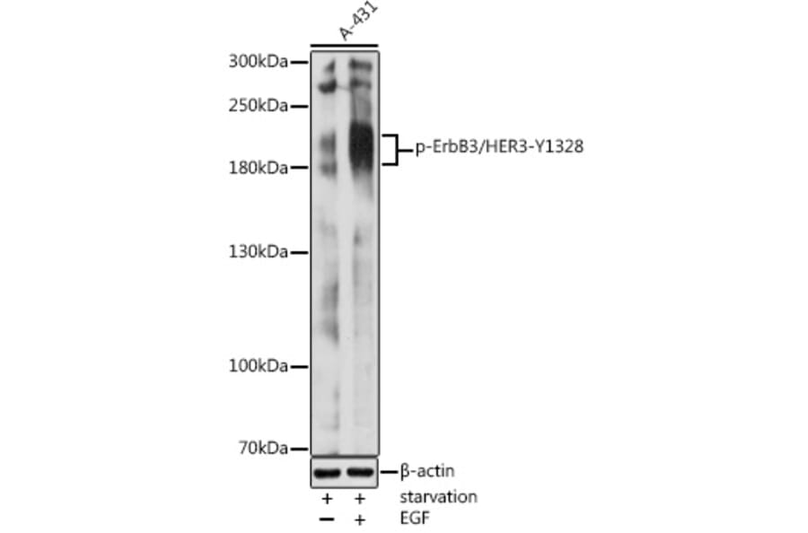 Western Blot - Anti-ErbB3/HER3 (phospho Tyr1328) Antibody (A16564) - Antibodies.com