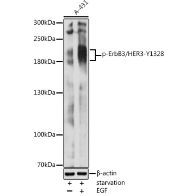 Western Blot - Anti-ErbB3/HER3 (phospho Tyr1328) Antibody (A16564) - Antibodies.com