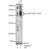 Western Blot - Anti-ErbB3/HER3 (phospho Tyr1328) Antibody (A16564) - Antibodies.com