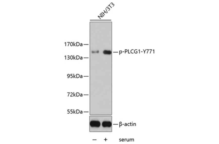 Western Blot - Anti-PLCG1 (phospho Y771) Antibody (AP0281) - Antibodies.com