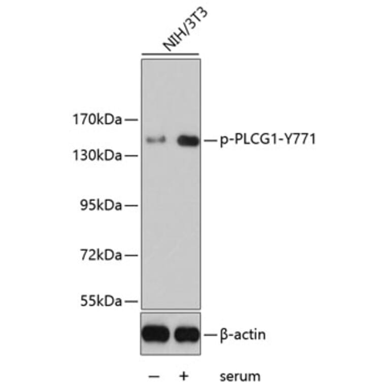 Western Blot - Anti-PLCG1 (phospho Y771) Antibody (AP0281) - Antibodies.com
