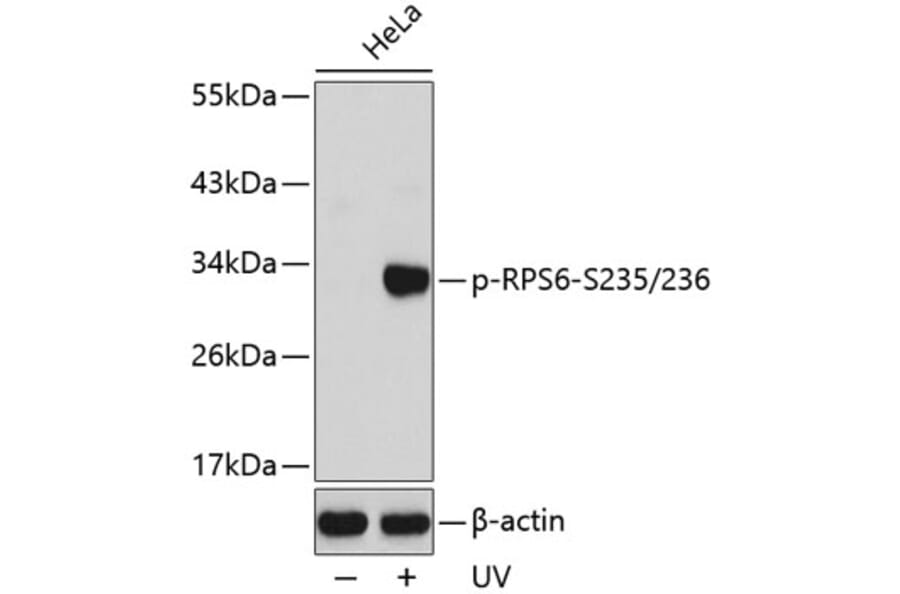 Western Blot - Anti-RPS6 (phospho S235 + S236) Antibody (AP0296) - Antibodies.com