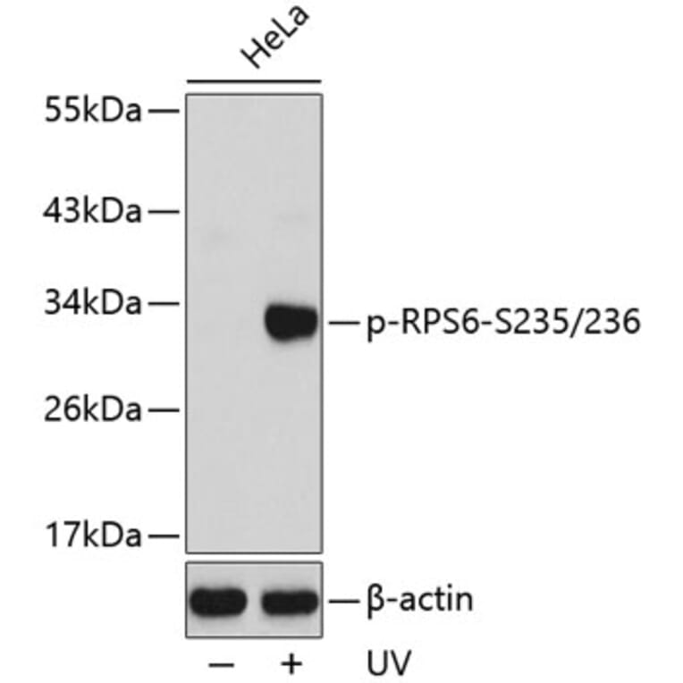 Western Blot - Anti-RPS6 (phospho S235 + S236) Antibody (AP0296) - Antibodies.com