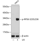 Western Blot - Anti-RPS6 (phospho S235 + S236) Antibody (AP0296) - Antibodies.com