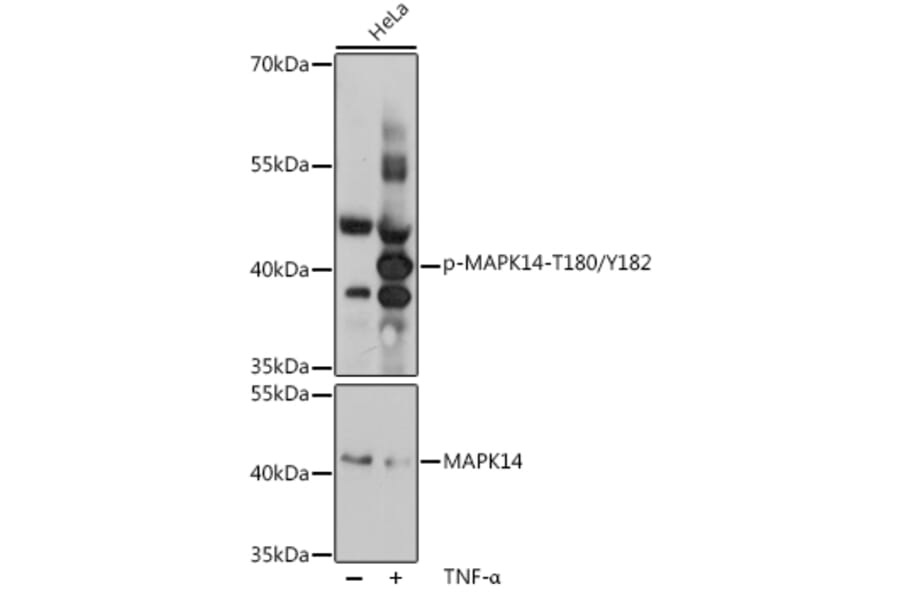 Western Blot - Anti-MAPK14 (Phospho T180/Y182) Antibody (A16568) - Antibodies.com