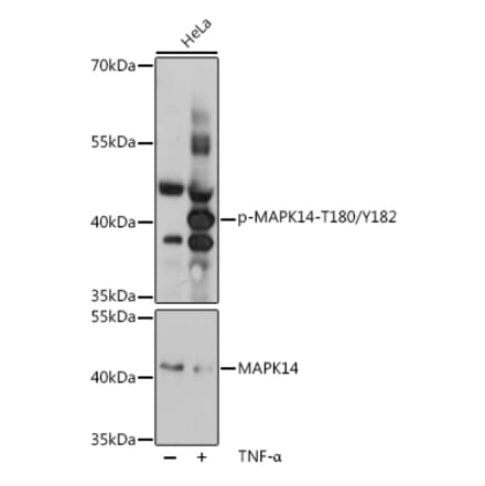 Western Blot - Anti-MAPK14 (Phospho T180/Y182) Antibody (A16568) - Antibodies.com