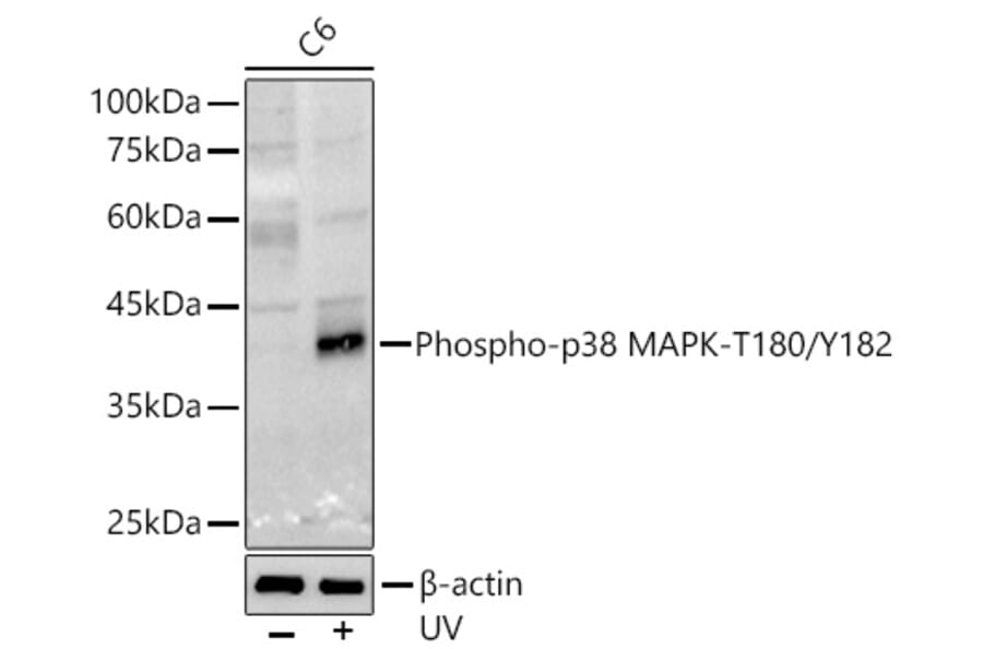 Western Blot - Anti-MAPK14 (Phospho T180/Y182) Antibody (A16568) - Antibodies.com