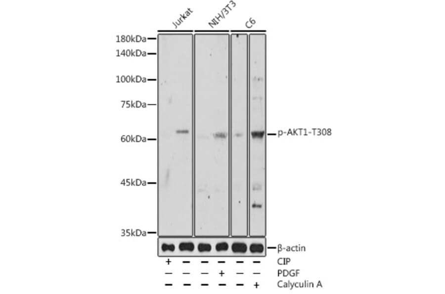 Western Blot - Anti-AKT1 (phospho Thr308) Antibody (A16569) - Antibodies.com