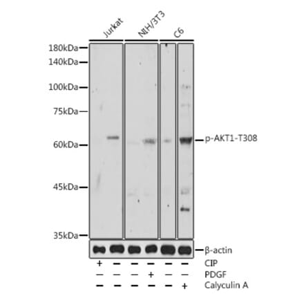 Western Blot - Anti-AKT1 (phospho Thr308) Antibody (A16569) - Antibodies.com
