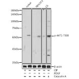 Western Blot - Anti-AKT1 (phospho Thr308) Antibody (A16569) - Antibodies.com