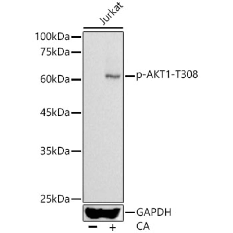 Western Blot - Anti-AKT1 (phospho Thr308) Antibody (A16569) - Antibodies.com