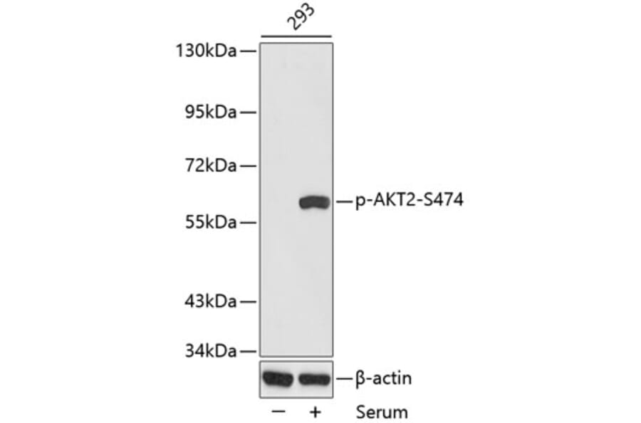 Western Blot - Anti-AKT2 (phospho S474) Antibody (AP0305) - Antibodies.com