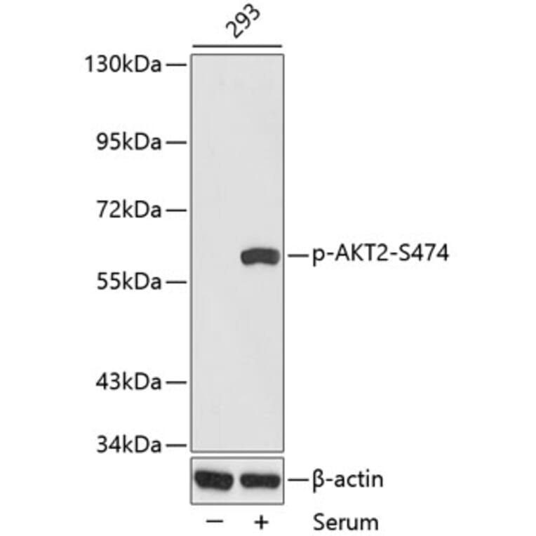 Western Blot - Anti-AKT2 (phospho S474) Antibody (AP0305) - Antibodies.com