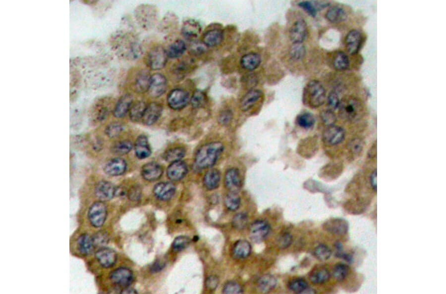 Immunohistochemistry - Anti-AKT2 (phospho S474) Antibody (AP0305) - Antibodies.com