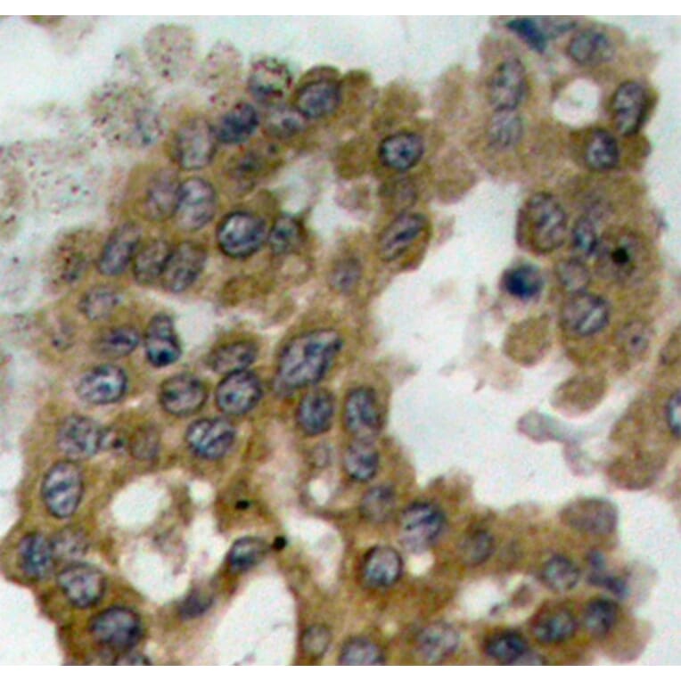 Immunohistochemistry - Anti-AKT2 (phospho S474) Antibody (AP0305) - Antibodies.com