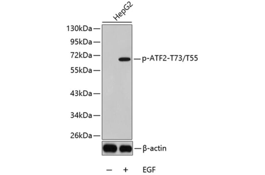 Western Blot - Anti-ATF2 (phospho T73 + T55) Antibody (AP0308) - Antibodies.com