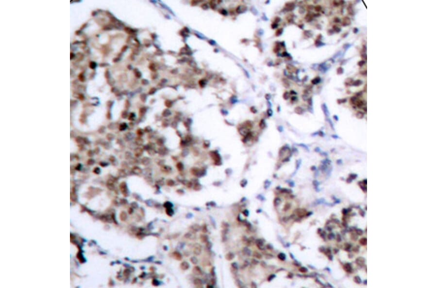 Immunohistochemistry - Anti-Bad (phospho S155) Antibody (AP0312) - Antibodies.com