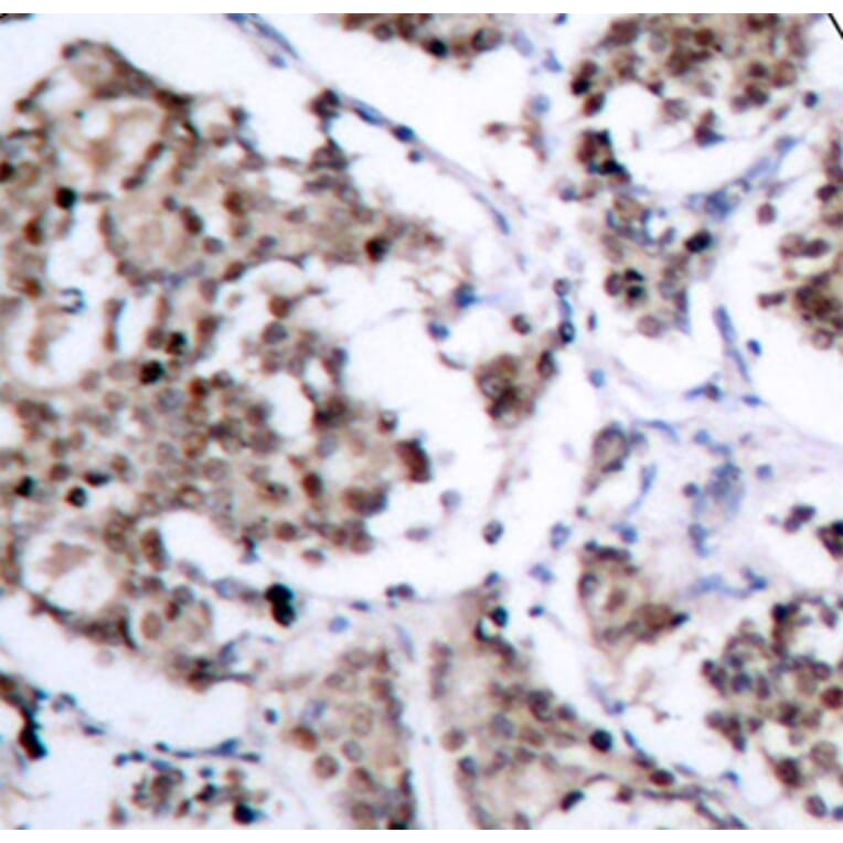 Immunohistochemistry - Anti-Bad (phospho S155) Antibody (AP0312) - Antibodies.com
