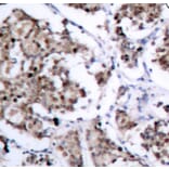 Immunohistochemistry - Anti-Bad (phospho S155) Antibody (AP0312) - Antibodies.com